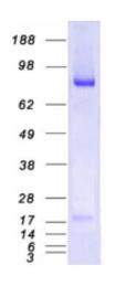 SDS-PAGE (MALT1-234H).jpg